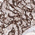 Immunohistochemical staining of human placenta shows strong cytoplasmic immunoreactivity in trophoblast.