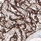 Immunohistochemical staining of human placenta shows strong cytoplasmic immunoreactivity in trophoblast.