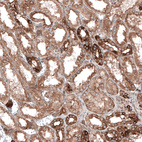 Immunohistochemical staining of human kidney shows moderate to strong cytoplasmic immunoreactivity in renal tubules.