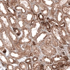 Immunohistochemical staining of human kidney shows moderate to strong cytoplasmic immunoreactivity in renal tubules.