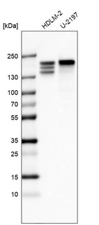 Western blot analysis in human cell line HDLM-2 and human cell line U-2197.