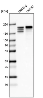 Western blot analysis in human cell line HDLM-2 and human cell line U-2197.