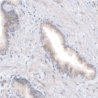 Anti-CDKL5 Antibody