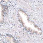 Immunohistochemical staining of human prostate shows weak cytoplasmic positivity in glandular cells.
