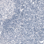 Anti-CDKL5 Antibody