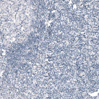Immunohistochemical staining of human tonsil shows no positivity in lymphoid cells as expected.