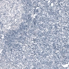Immunohistochemical staining of human tonsil shows no positivity in lymphoid cells as expected.