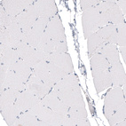 Immunohistochemical staining of human skeletal muscle shows no positivity as expected.