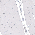 Anti-CDKL5 Antibody