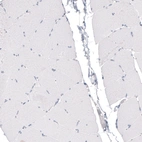 Immunohistochemical staining of human skeletal muscle shows no positivity as expected.