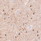 Anti-CDKL5 Antibody