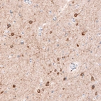 Anti-CDKL5 Antibody