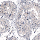 Anti-CDKL5 Antibody