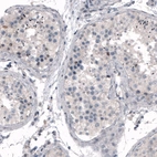 Immunohistochemical staining of human testis shows weak nuclear positivity in a subset of cells in seminiferous tubules.