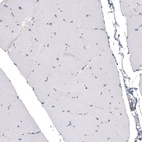 Anti-CDKL5 Antibody