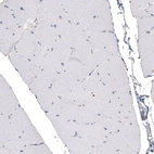 Immunohistochemical staining of skeletal muscle shows absence of positivity in muscle fibres as expected (negative control).