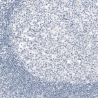 Immunohistochemical staining of human tonsil shows no positivity in lymphoid cells as expected (negative control).