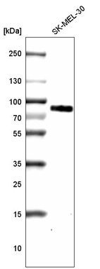 Western blot analysis in human cell line SK-MEL-30.