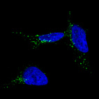 Immunofluorescence staining of SK-MEL-30 cells using the Anti-TYRP1 monoclonal antibody, showing specific staining in the vesicles in green. Microtubule- and nuclear probes are visualized in red and blue, respectively (where available).