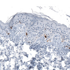 Anti-TYRP1 Antibody