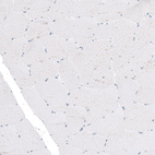 Immunohistochemical staining of human skeletal muscle shows no positivity in muscle fibers as expected (negative control).