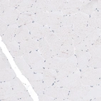 Immunohistochemical staining of human skeletal muscle shows no positivity in muscle fibers as expected (negative control).