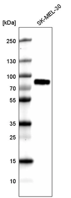 Western blot analysis in human cell line SK-MEL-30.