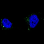 Immunofluorescence staining of SK-MEL-30 cells using the Anti-TYRP1 monoclonal antibody, showing specific staining in the vesicles in green. Microtubule- and nuclear probes are visualized in red and blue, respectively (where available).