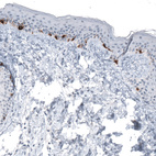 Anti-TYRP1 Antibody