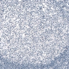 Immunohistochemical staining of human tonsil shows no positivity in lymphoid cells as expected (negative control).