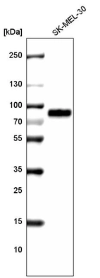 Western blot analysis in human cell line SK-MEL-30.