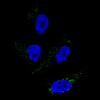 Anti-TYRP1 Antibody