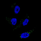 Immunofluorescence staining of SK-MEL-30 cells using the Anti-TYRP1 monoclonal antibody, showing specific staining in the vesicles in green. Microtubule- and nuclear probes are visualized in red and blue, respectively (where available).