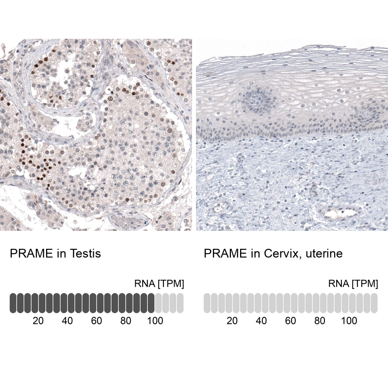 Mouse Monoclonal Anti-PRAME Antibody - Buy for research - Highly ...