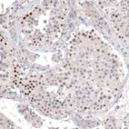 Immunohistochemical staining of human testis shows strong nuclear positivity in a subset of cells in seminiferous ducts.