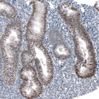 Immunohistochemical staining of human endometrium shows moderate nuclear positivity in glandular cells.