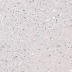 Immunohistochemical staining of human cerebral cortex shows no positivity in neurons as expected.