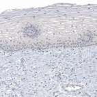Immunohistochemical staining of human uterine cervix shows no positivity in squamous epithelial cells as expected.