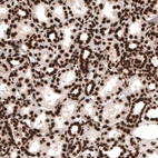 Immunohistochemical staining of human kidney shows strong nuclear positivity in renal tubules cells.