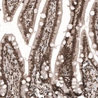 Immunohistochemical staining of human duodenum shows strong nuclear immunoreactivity in glandular cells as well as in cells in lamina propria.