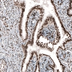 Immunohistochemical staining of human fallopian tube shows strong nuclear positivity in glandular and stromal cells.