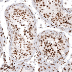 Anti-HIST1H2AG Antibody