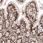 Immunohistochemical staining of human small intestine shows strong nuclear positivity in glandular cells.