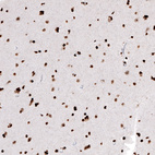 Immunohistochemical staining of human cerebral cortex shows strong nuclear positivity in neurons.
