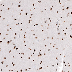 Anti-HIST1H2AG Antibody