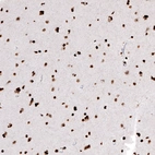 Immunohistochemical staining of human cerebral cortex shows strong nuclear positivity in neurons.