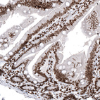 Anti-HIST1H2AG Antibody