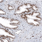 Immunohistochemical staining of human prostate shows strong nuclear positivity in glandular and smooth muscle cells.