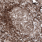 Anti-HIST1H2AG Antibody