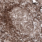 Immunohistochemical staining of human tonsil shows moderate to strong nuclear immunoreactivity in lymphoid cells.